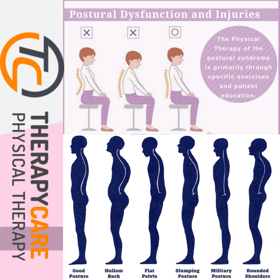 what is erect posture